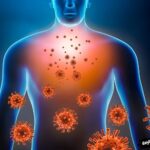 Managing an Overactive Immune System Strategies for Balance